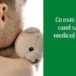 Ce este Rubeola si cand sa mergi la medicul specialist