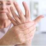 Artrita Reumatoidă, simptome, semne și manifestări 27 artrita reumatoida